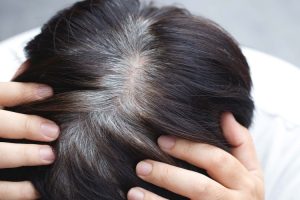 نکات مهم درباره انتخاب بهترین مارک رنگ مو برای موهای سفید